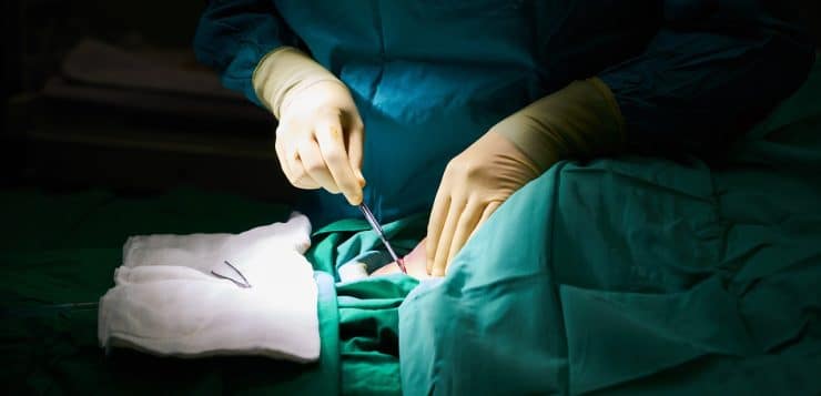 4 choses à savoir sur le traitement de la gynécomastie